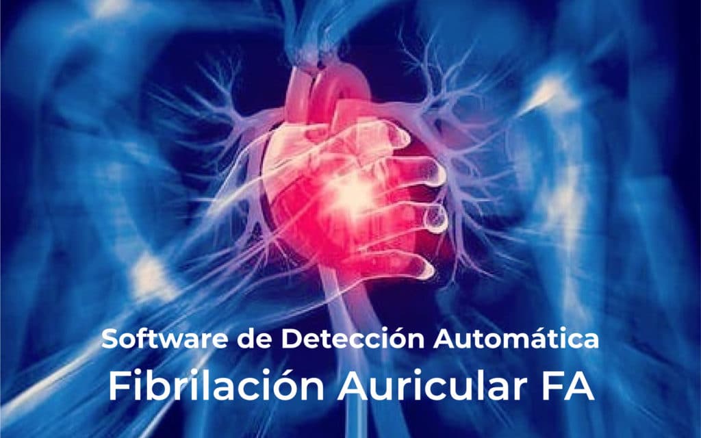 ¿Cómo detectar la Fibrilación Auricular?