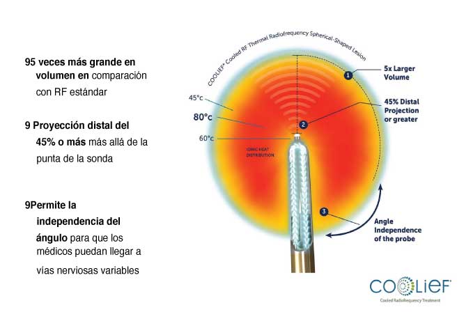 Radiofrecuencia Coolief