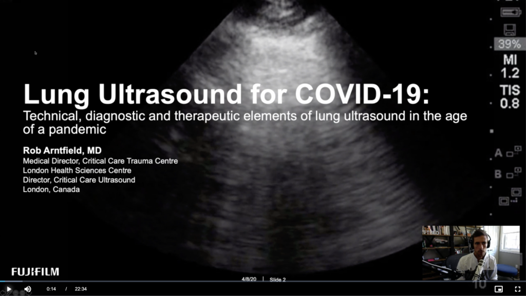 lung us covid19 ultrasonido pulmonar