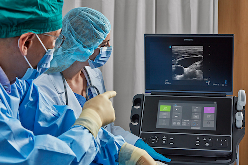 Sonosite PX Lifestyle Image L19-5 Critical Care