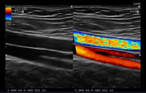 Vascular CF Dual Extremidad Inferior