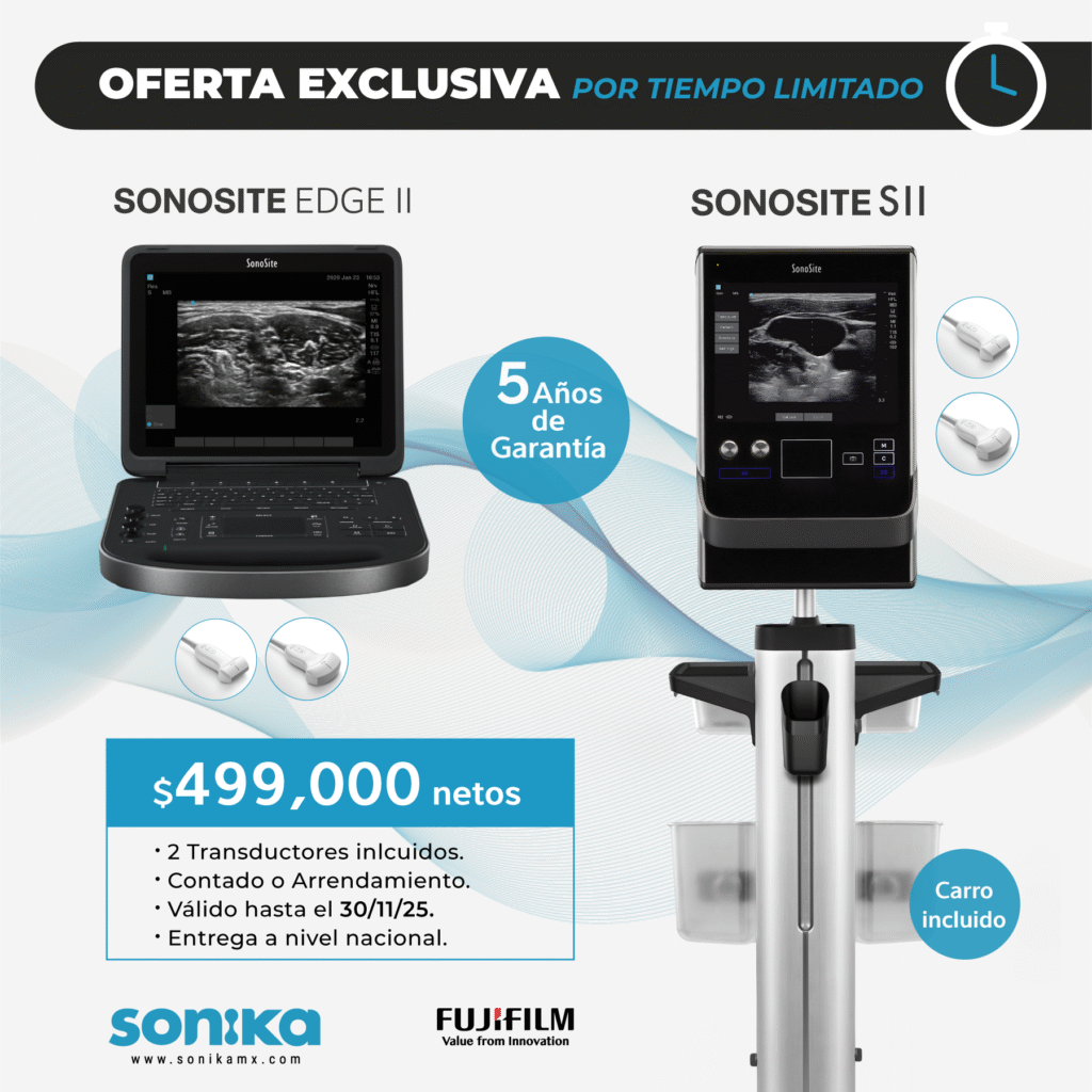OFERTA BUEN FIN SONOSITE