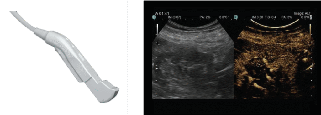 Transductor C22I Biopsia Abdominal