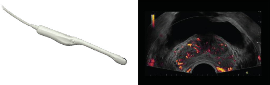 Transductor C41V Biopsia Transrectal Próstata