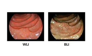 Eluxeo wli-bli