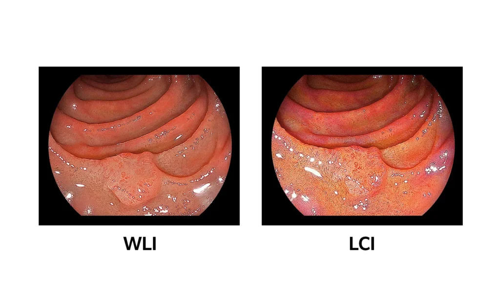 Eluxeo wli-lci