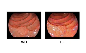 Eluxeo wli-lci