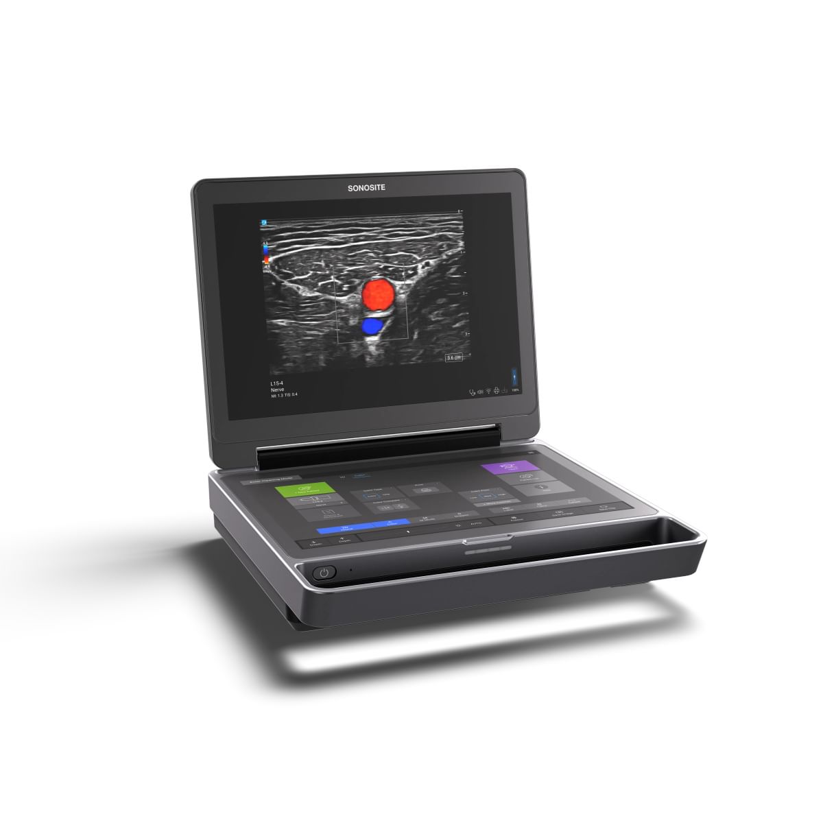Sonosite MT Nerve Adductor Canal Color