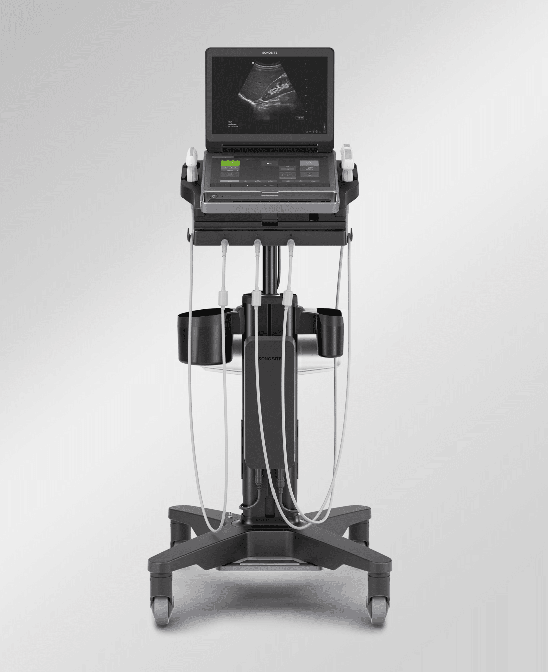 Sonosite MT - Imagen 2